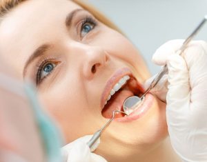 Dental Checkups in Birmingham 3 dental checkups birmingham