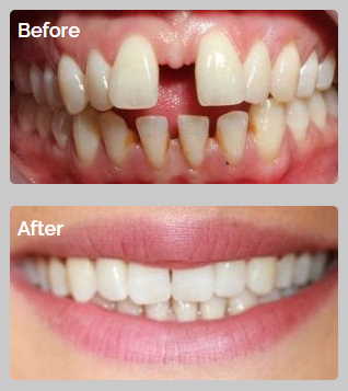 All Orthodontics Options 10 04 24 27 case1