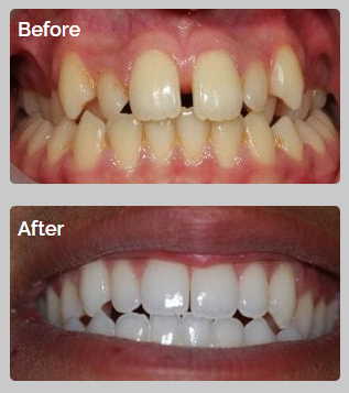 All Orthodontics Options 10 04 24 26 case5