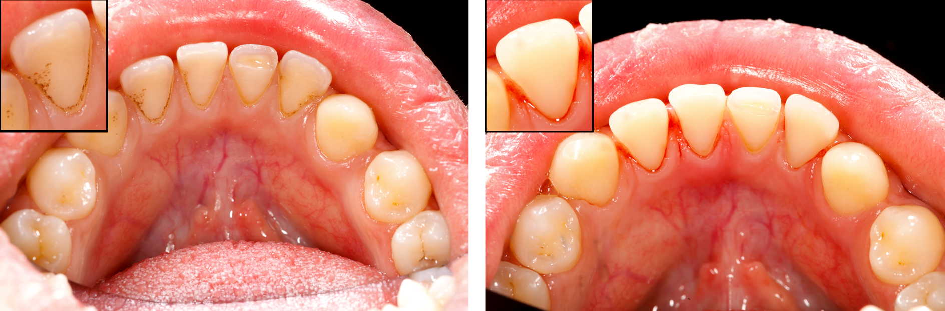 The Importance of Dental Hygiene in Birmingham: Maintaining a Radiant Smile 2 dental hygiene in birmingham