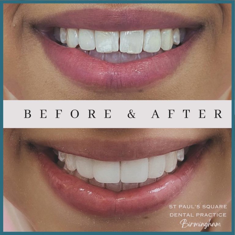 Cosmetic Dentist Birmingham