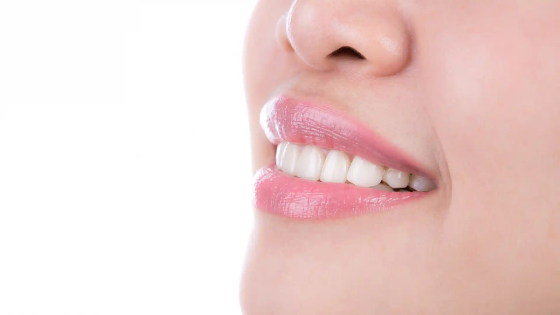 Dental Blog 13 bright smile showing results of professional teeth whitening in Birmingham