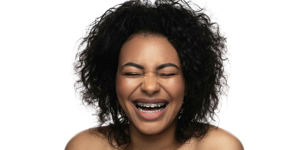 Why More Birmingham Adults Are Straightening Their Teeth in 2026 2 woman with braces laughing, showing orthodontic treatment results